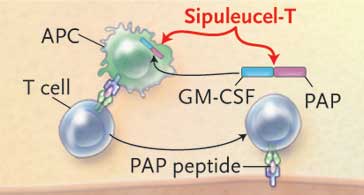Thumbnail Graphic -- Sipuleucel-T Immunotherapy for Castration-Resistant Prostate Cancer